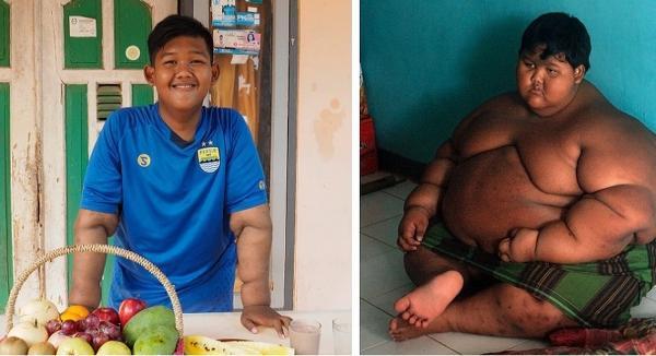 آریا پرمانا چاق ترین کودک جهان که با کاهش وزنش شگفتی ساز شد